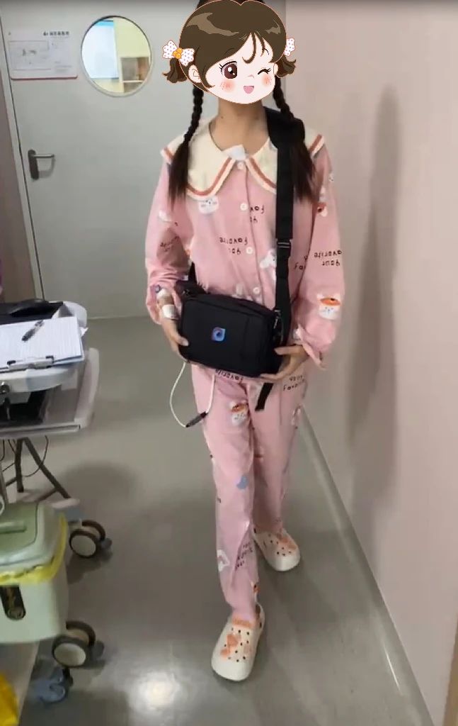 2023年,美美术后佩戴人工心的照片。图片由浙大儿院提供